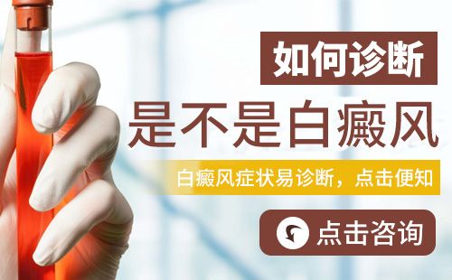 诊断治疗-早期的白癜风在治疗的时候有哪些优势